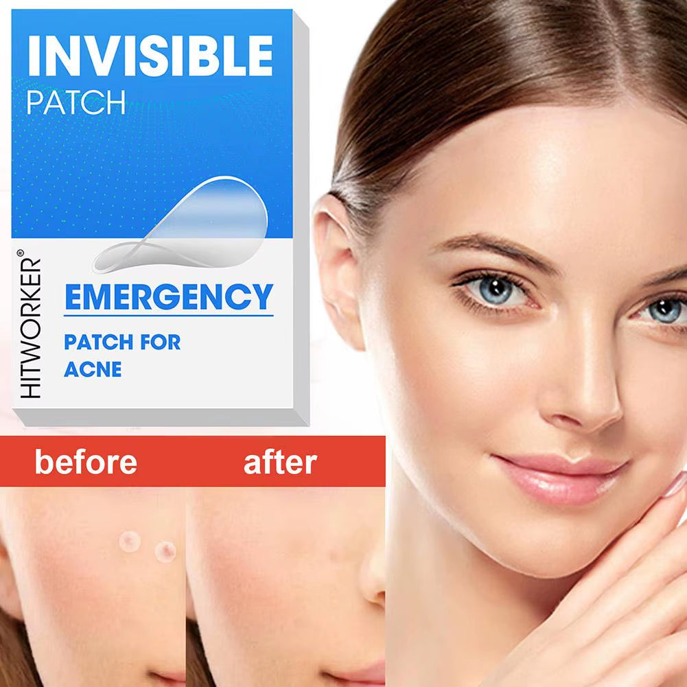 400/800/1200Pcs Acne Patches Skincare Stickers Circular Transparent Skin Tone Facial Spot Covering Makeup Tools for Clear Skin