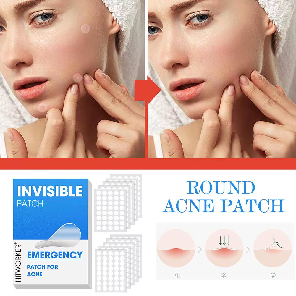 400/800/1200Pcs Acne Patches Skincare Stickers Circular Transparent Skin Tone Facial Spot Covering Makeup Tools for Clear Skin